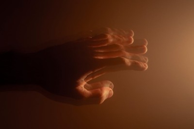 Severe hand tremors? Lesioning surgery can fix it in one hour. Here's how it works for Parkinson’s, dystonia patients