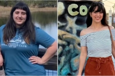 Woman who lost 54 kg reveals mistakes she made on her PCOS weight loss journey: ‘I went 100% gluten and dairy-free’